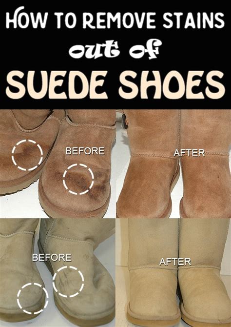 remove stains from suede shoes.